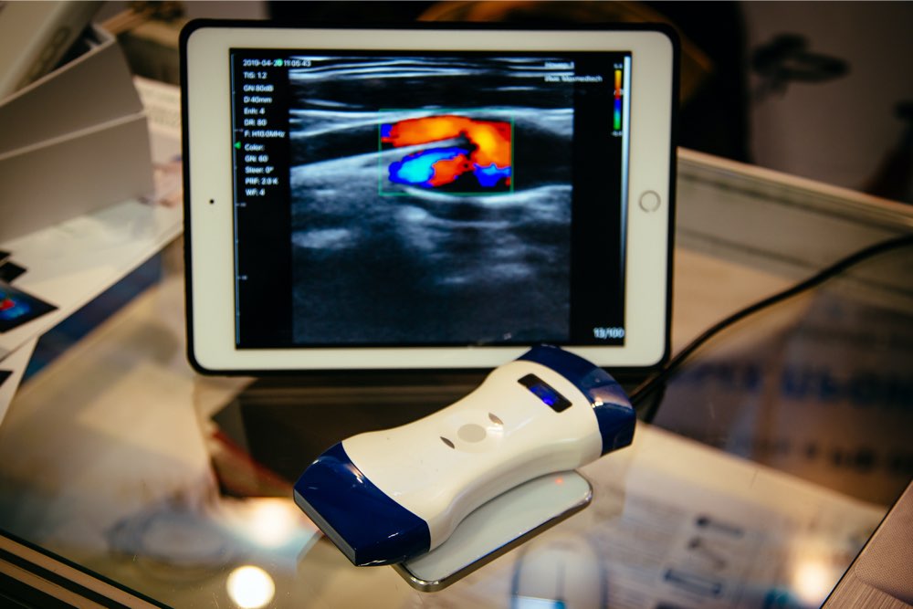 Portable ultrasound machines – Types and top choices